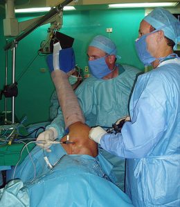 Arthroscopy Surgery